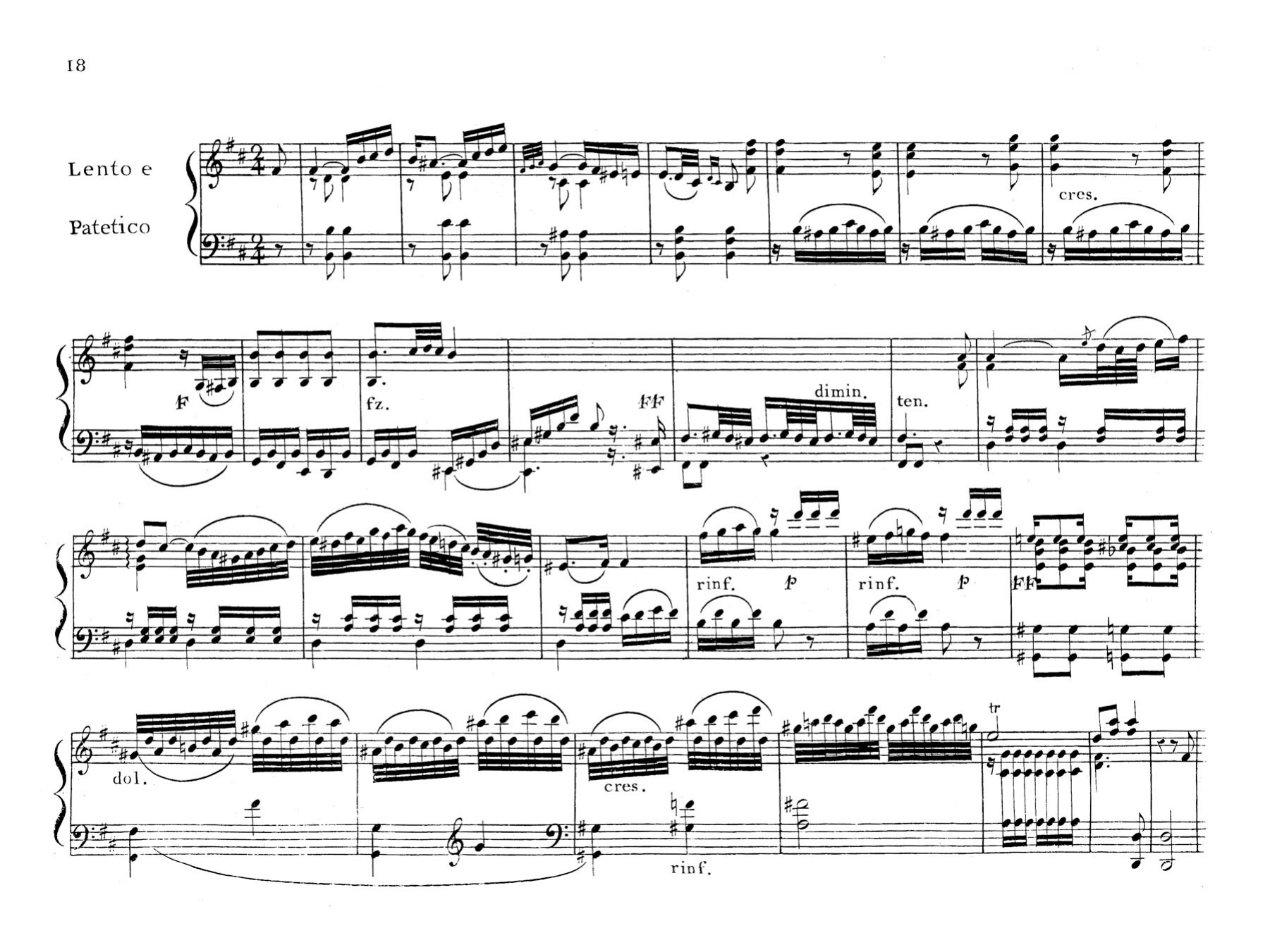 6 Piano Sonatas, Op.25 [#608827].pdf